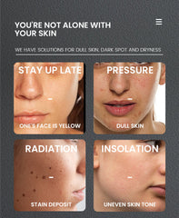 Whitening Face Hydrating And Brightening Anti-wrinkle Skin Moisturizing Lotion