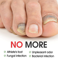 7DAYS Nail Fungus Treatment Serum Care Hand And Foot Care Removal