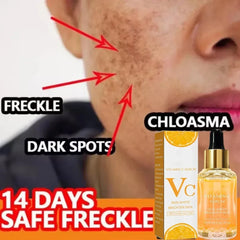 Vitamin C Remove Dark Spots Serum