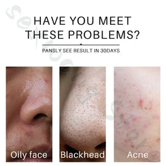 Black Tea Blackhead Removal Mask Peel-off Pore Shrinking Blackhead Oil Control