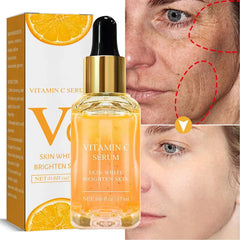 Vitamin C Remove Dark Spots Serum