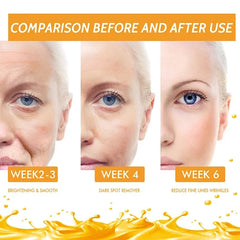 Vitamin C Remove Dark Spots Serum