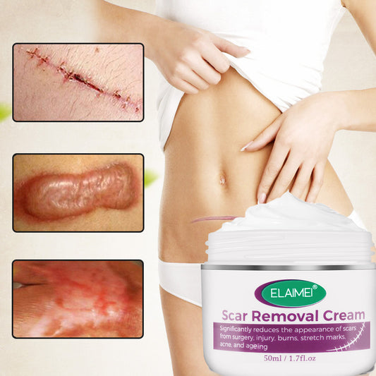 Skin Rebound Scarless Cream Scar Removal Cream