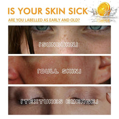 Vitamin C Remove Dark Spots Serum