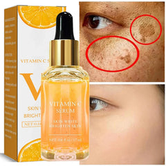 Vitamin C Remove Dark Spots Serum