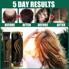 Regrowth Organic Hair Serum Roller Set Hair Care